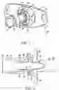 Fig. 02 - Tracheostomy tube assemblies and inner cannulae