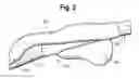 Fig. 04 - ENDOTRACHEAL TUBE AND METHOD OF USE THEREOF
