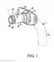 Fig. 02 - Tracheostomy tube assemblies and inner cannulae