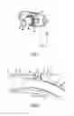 Fig. 08 - Tracheostomy tube assemblies and inner cannulae