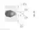 Fig. 09 - Methods and systems for neural stimulation via auditory stimulation