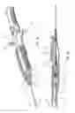 Fig. 05 - Guidewire extension system for a catheter placement device