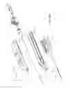 Fig. 22 - Guidewire extension system for a catheter placement device