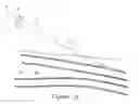 Fig. 03 - Systems and methods for percutaneous intravascular access and guidewire placement
