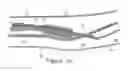 Fig. 10 - Systems and methods for percutaneous intravascular access and guidewire placement