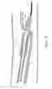 Fig. 14 - Systems and methods for percutaneous intravascular access and guidewire placement