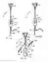 Fig. 07 - System and method for delivering therapeutic agents to the uterine cavity