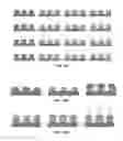 Fig. 25 - MICROSTRUCTURE-BASED DRUG DELIVERY SYSTEM COMPRISING MICROPOROUS STRUCTURE