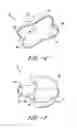 Fig. 04 - Catheter connector insert