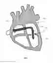Fig. 02 - Delivery catheter distal cap