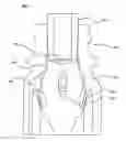 Fig. 01 - Piston for a needleless valve system