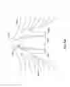 Fig. 07 - ELECTRODE FOR SENSING, PACING, AND DEFIBRILLATION DEPLOYABLE IN THE MEDIASTINAL SPACE