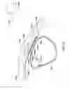 Fig. 40 - ELECTRODE FOR SENSING, PACING, AND DEFIBRILLATION DEPLOYABLE IN THE MEDIASTINAL SPACE