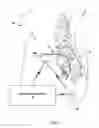Fig. 02 - Stimulation vector selection using pulse width data