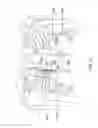 Fig. 06 - Parasternal placement of an active medical device using the internal thoracic vasculature