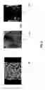 Fig. 07 - Three dimensional localization and tracking for adaptive radiation therapy
