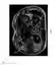 Fig. 07 - Assessment and improvement of treatment using imaging of physiological responses to radiation therapy