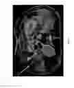 Fig. 08 - Assessment and improvement of treatment using imaging of physiological responses to radiation therapy