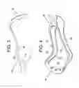 Fig. 03 - WOMEN'S LACROSSE STICK HEAD