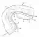 Fig. 01 - Protective Mouthguard