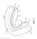 Fig. 02 - Protective Mouthguard