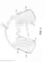 Fig. 04 - Protective Mouthguard