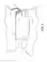 Fig. 07 - Protective Mouthguard