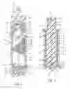 Fig. 02 - Systems and methods for platelet concentration with a spinning membrane separator
