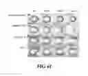 Fig. 76 - Apparatus for a mass production of monodisperse biodegradeable polymer-based microspheres and a multi-channel forming device incorporatable therein