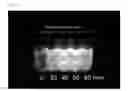 Fig. 05 - Photoluminescent carbon nanoparticles and method of preparing the same