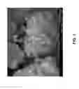 Fig. 02 - Synthesis of MTW framework type zeolites via interzeolite transformation