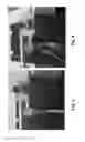 Fig. 04 - DEVICES AND METHODS FOR PRODUCTION OF HOLLOW CYLINDRICAL STRUCTURES AND HOLLOW CYLINDRICAL STRUCTURES