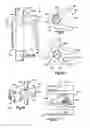 Fig. 08 - METHOD OF USING ULTRASONIC VIBRATION TO SECURE BODY TISSUE