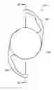Fig. 01 - Process for manufacturing an intraocular lens with an embedded mask