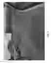 Fig. 04 - VEHICLE VISION SYSTEM WITH BLIND ZONE DISPLAY AND ALERT SYSTEM