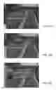 Fig. 22 - VEHICLE VISION SYSTEM WITH BLIND ZONE DISPLAY AND ALERT SYSTEM
