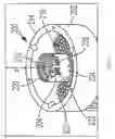 Fig. 08 - Feeder and method for feeding components into an assembly line