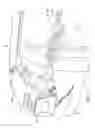 Fig. 07 - Safety device for mobile work platforms