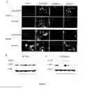 Fig. 06 - Methods and Pharmaceutical Compositions (NTSR1 Inhibitors) for the Treatment of Hepatocellular Carcinomas