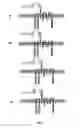 Fig. 04 - CD123 SPECIFIC MULTI-CHAIN CHIMERIC ANTIGEN RECEPTOR