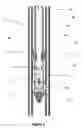 Fig. 02 - WELLBORE CLEANOUT SYSTEM