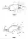 Fig. 06 - WIND TURBINE ROTOR BLADE