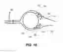 Fig. 08 - WIND TURBINE ROTOR BLADE