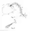 Fig. 02 - Radially compressible and expandable rotor for a fluid pump