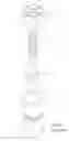 Fig. 02 - Check valve