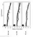 Fig. 18 - Hydrogel microphone