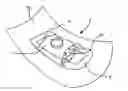 Fig. 01 - Mounting patch for a tire
