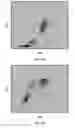 Fig. 03 - Basophil analysis system and method