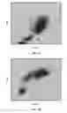 Fig. 08 - Basophil analysis system and method