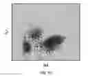 Fig. 09 - Basophil analysis system and method